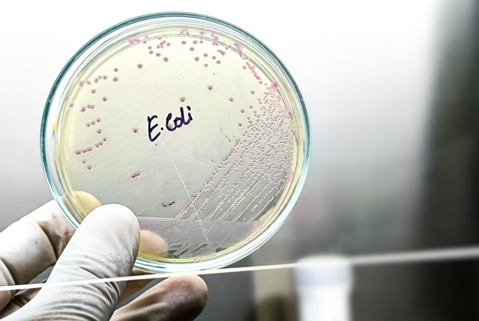 escherichia coli coltura su piastra di petri