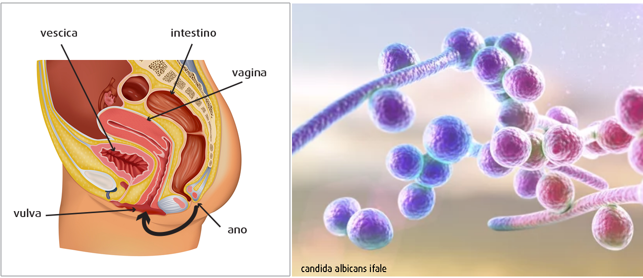 Vagina-e-Candida-albicans-ifale