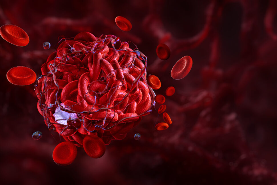 Il ruolo degli enzimi proteolitici nei processi infiammatori, rete di fibrina